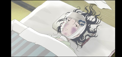 In questo angolo di mondo - Kono sekai no katasumi ni - film di animazione giapponese 2016 - anime -  Suzu colpita da una bomba